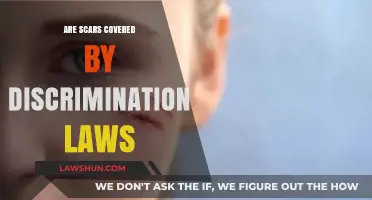Scars and Discrimination Laws: Are Visible Marks Legally Protected?