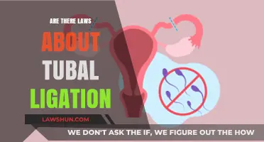 Tubal Ligation Laws: Understanding Legal Regulations and Patient Rights