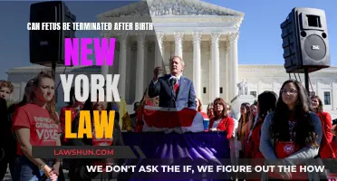 New York Law: Fetal Termination Rights After Birth