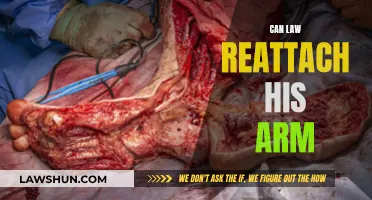 Reattaching Limbs: Can Law Get His Arm Back?