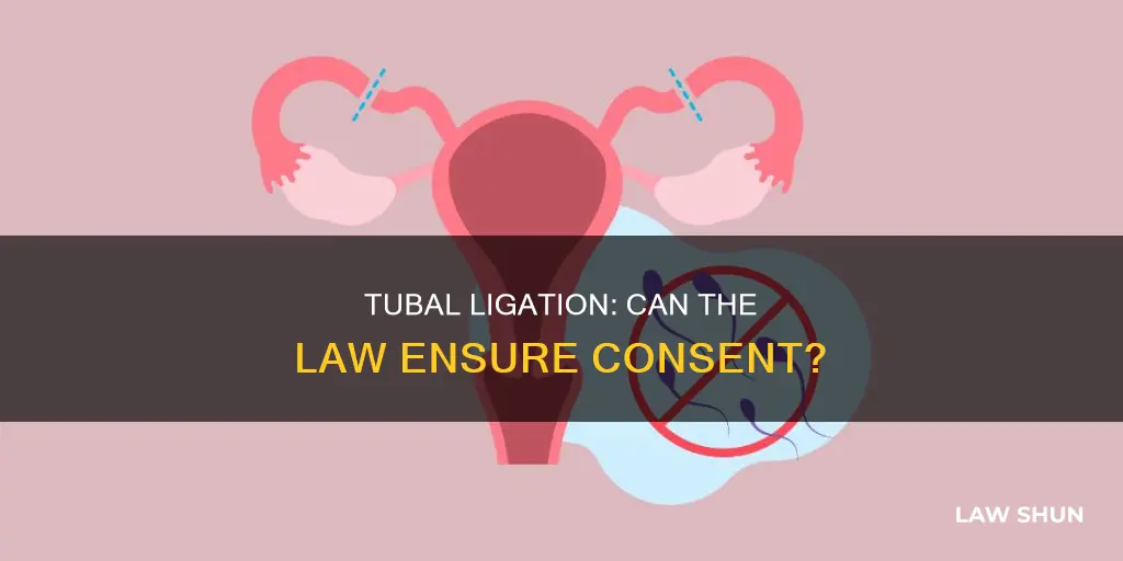can the law prevent a tubal ligatin