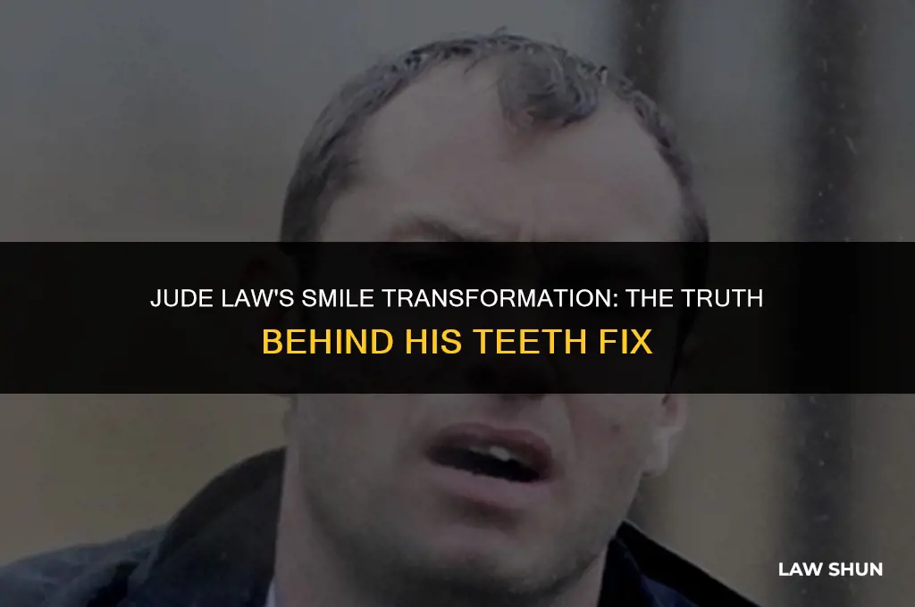 did jude law fix his teeth
