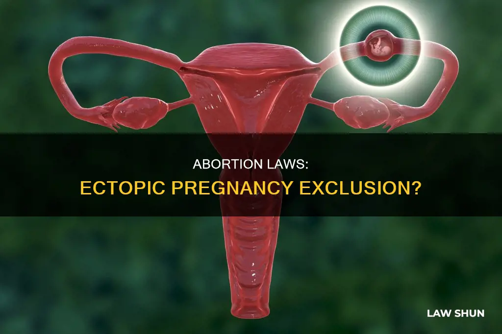 do abortion laws apply to ectopic pregnancies