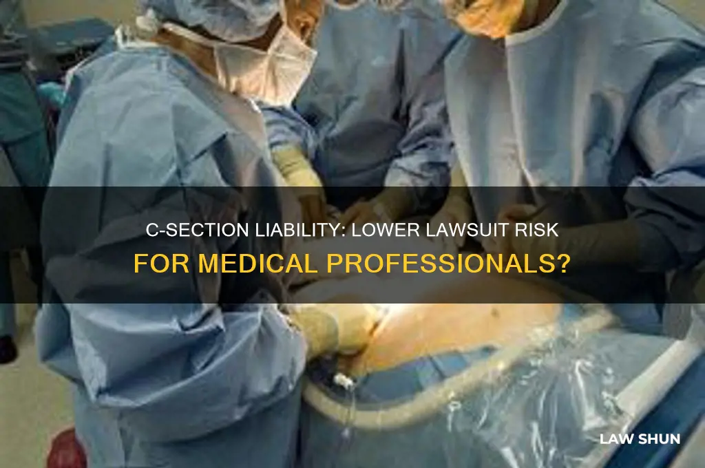 does csection warrant a less posibility for a law suit