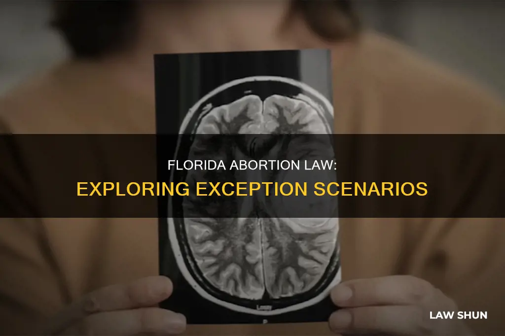 does florida abortion law allow exceptions