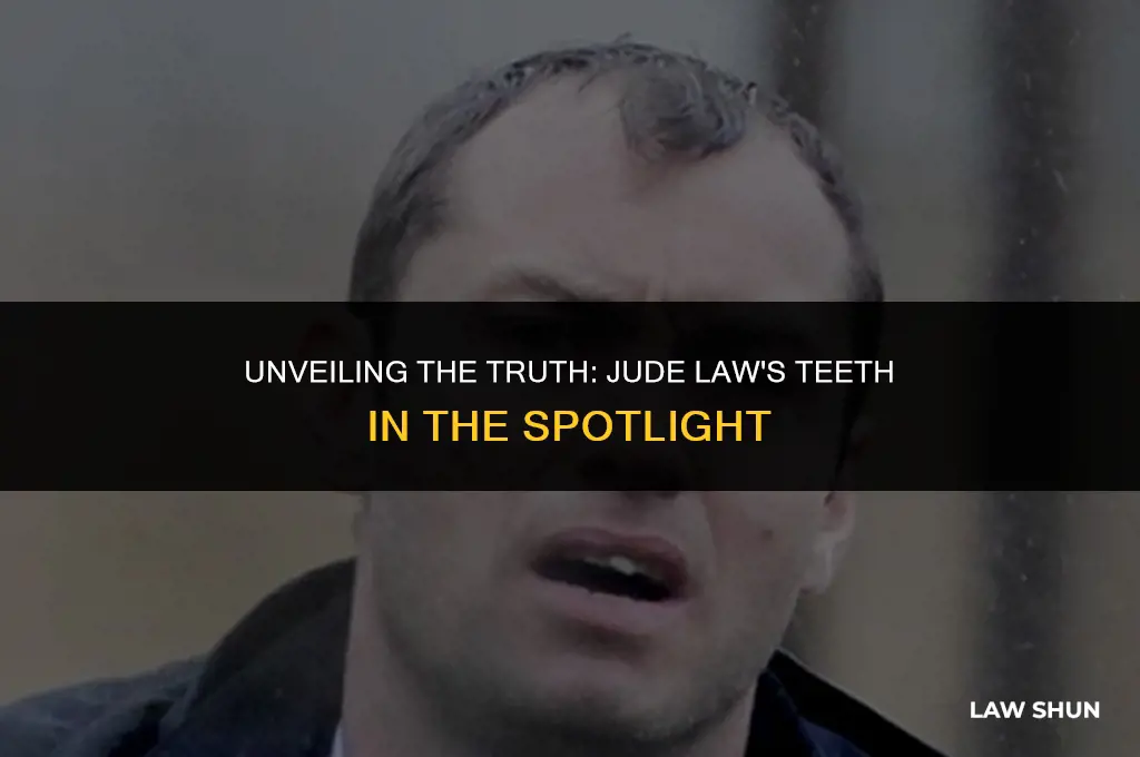 does jude law have bad teeth