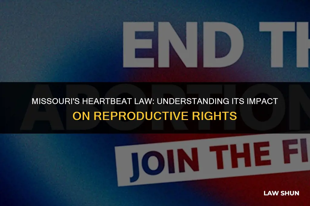 does missouri have a heartbeat law