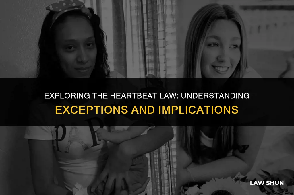 does the heartbeat law have exceptions