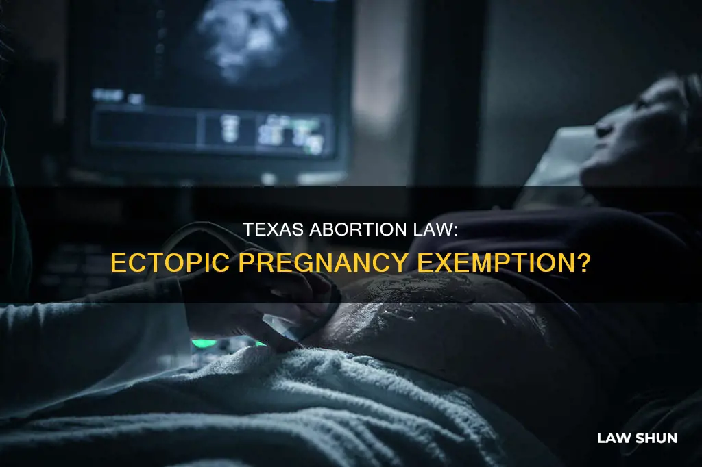 does the texas abortion law apply to ectopic pregnancies