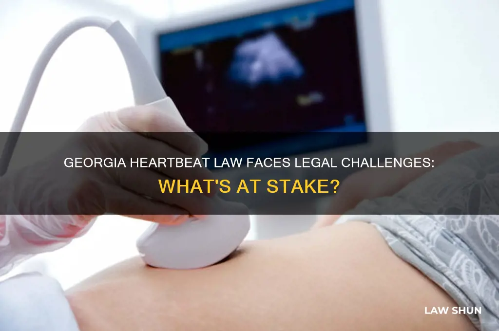 has georgia heartbeat law been challenged