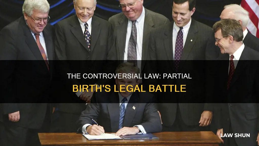 how did partial birth become law