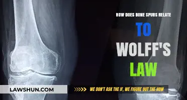 Bone Spurs and Wolff's Law: Understanding the Connection