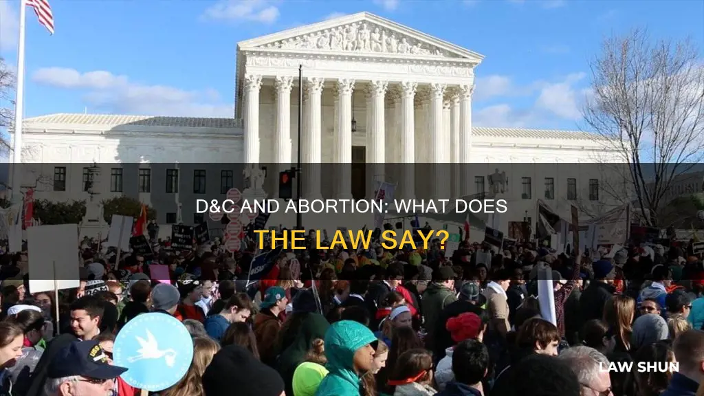 is a d&c an abortion by law