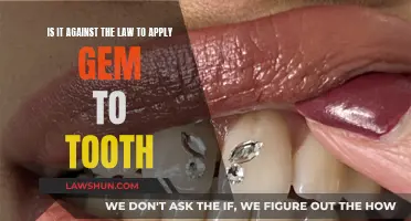 Tooth Gems: Are They Legal?