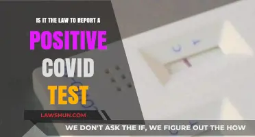 Legal Obligations: Must You Report a Positive COVID Test?