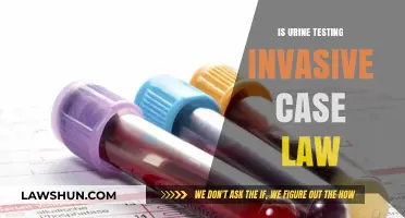 Urine Testing: Privacy vs. Law
