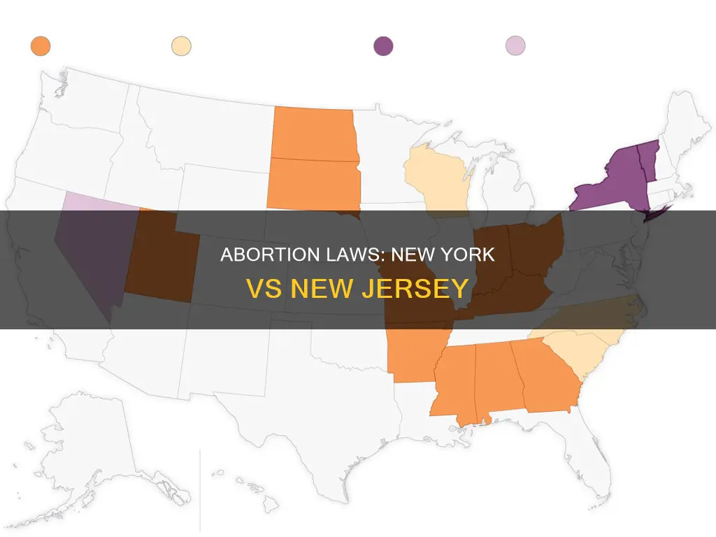 what are the differences between ny and nj abortion laws