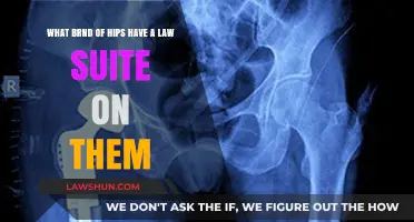 Legal Battle: Which Hip Implant Brands Face Lawsuits and Why?