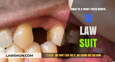 Front Tooth Lawsuit Value: Legal Compensation for Dental Injuries Explained