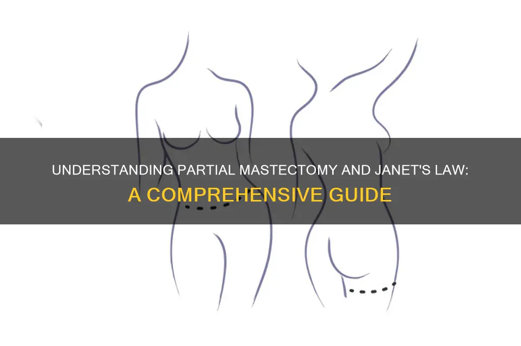 what is considered a partial mastectomy and janet