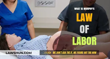 Understanding Murphy's Law of Labor: Challenges and Realities in Childbirth