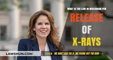 Wisconsin's X-Ray Release Laws: Understanding Patient Rights and Regulations