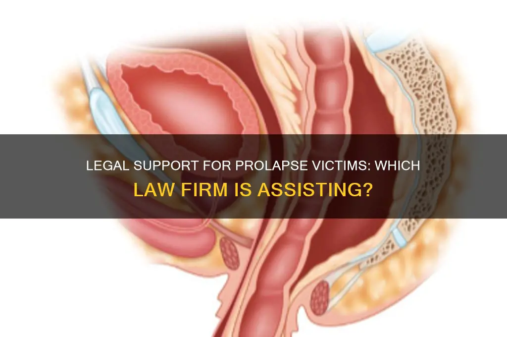 what law office is helping victims of prolapse