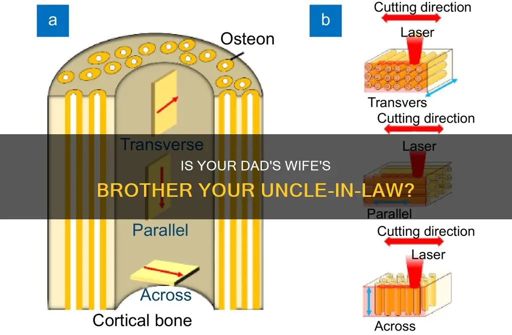 would your dads wifes brother be your uncle in law